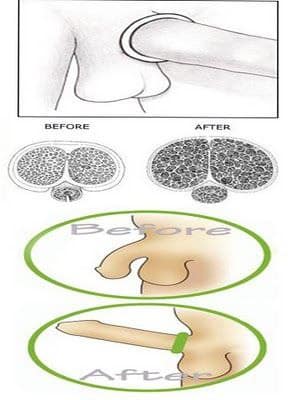 CINCIN KUDA HITAM 3 CINCIN KUDA HITAM